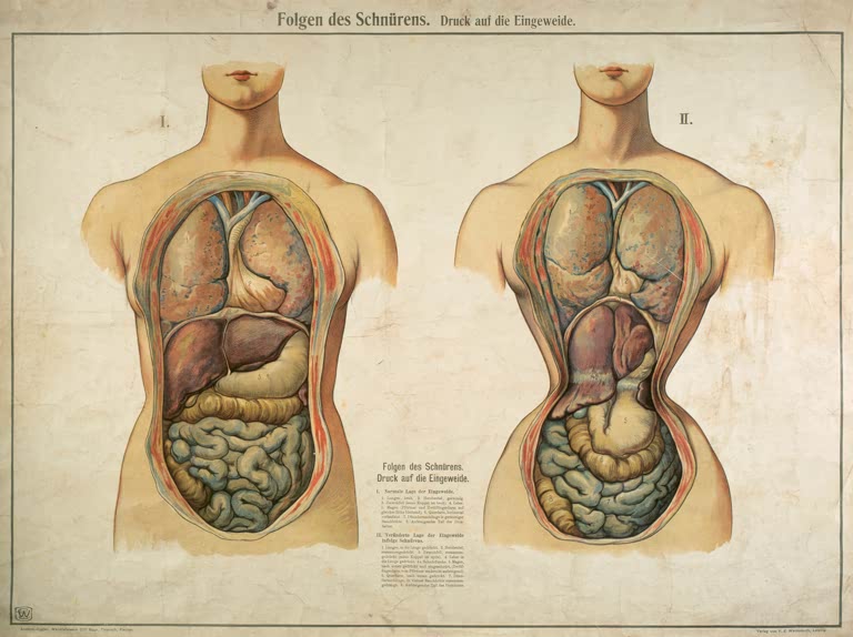 Conséquences du port du corset / Tableau